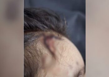 Casa foi lavada e criança arrastada após espancamento, diz delegado